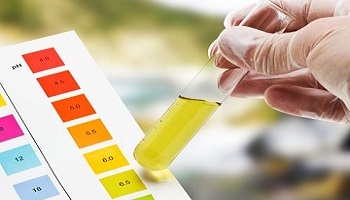 urine test