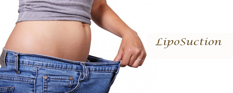 liposuction treatmnet